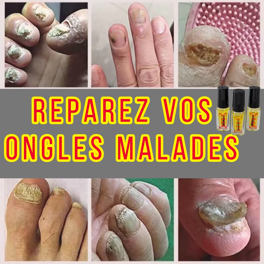 Huile des Ongles