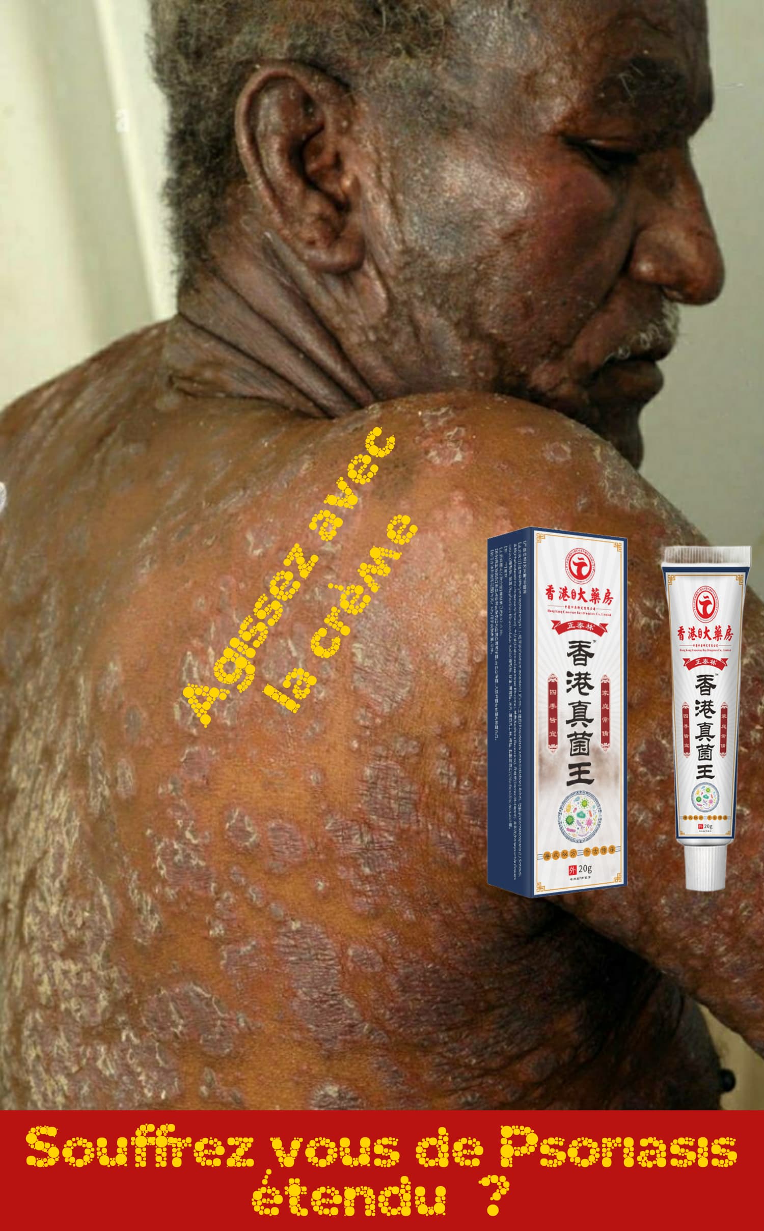 Crème Anti-Bactérienne