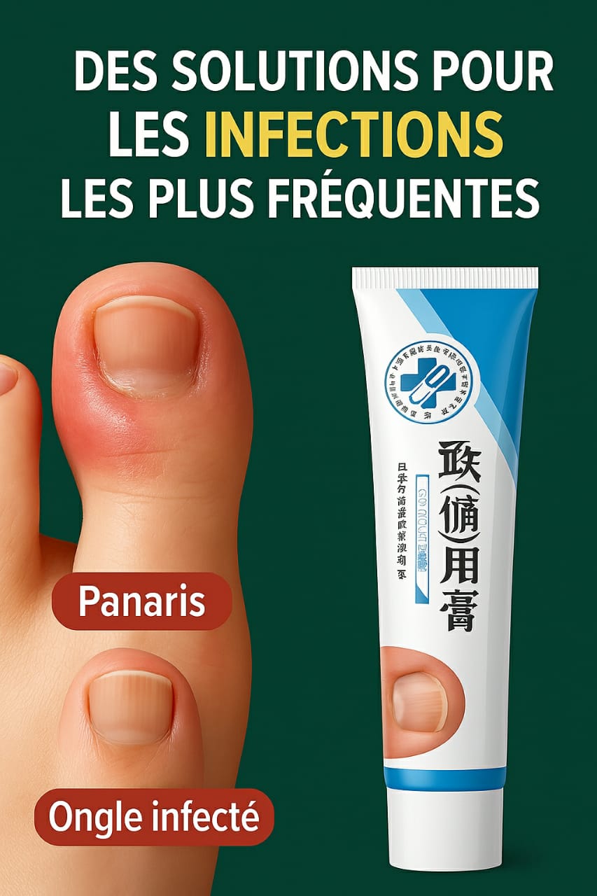 Illustration des stries sur les ongles