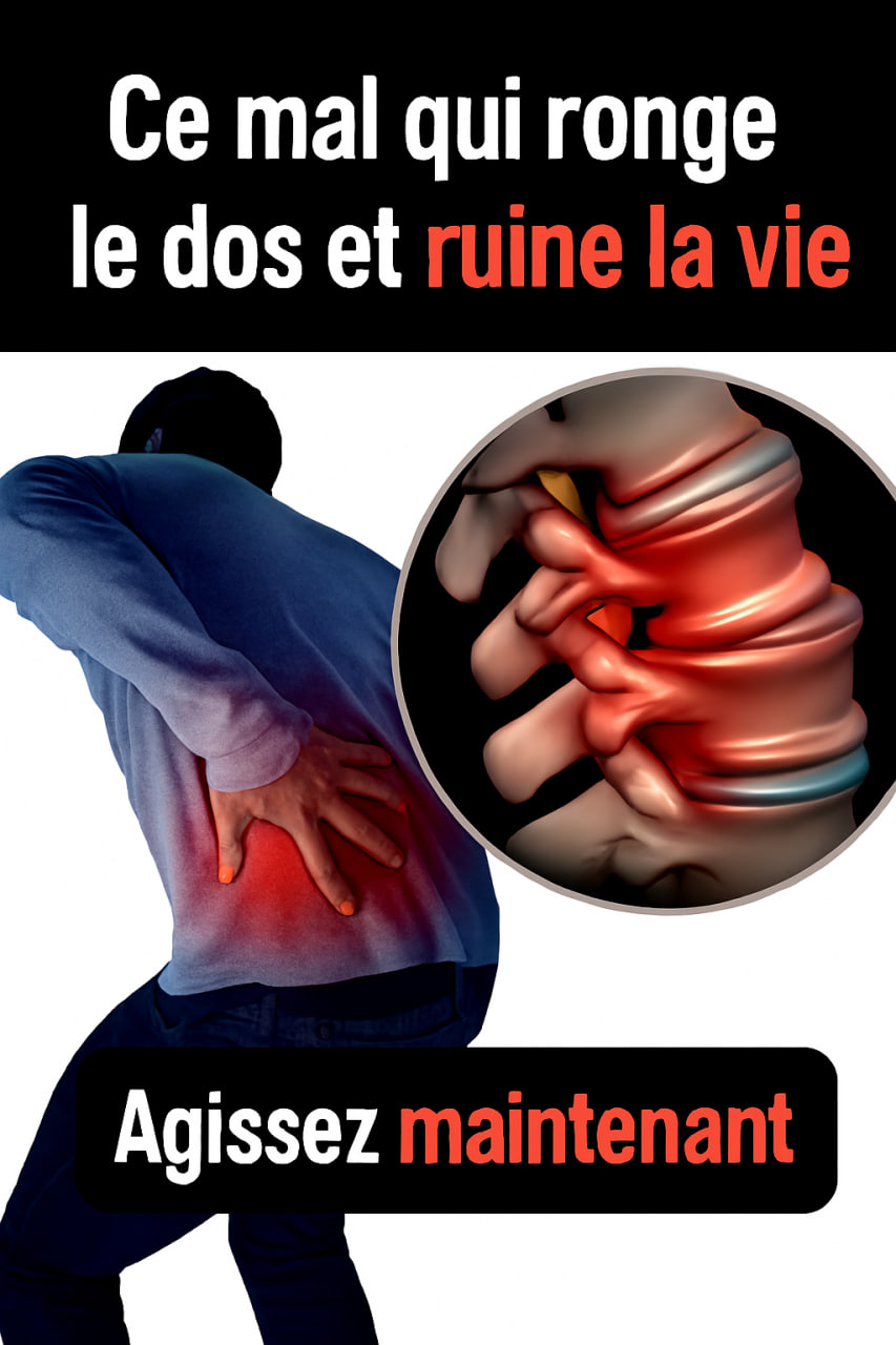 Effets néfastes d'une sciatique mal traitée